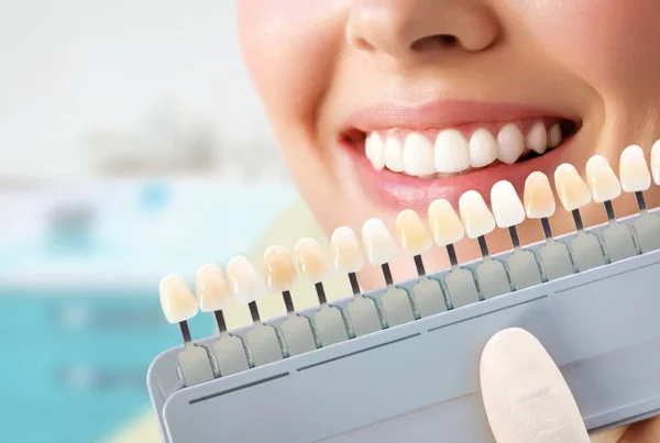 Teeth Whitening