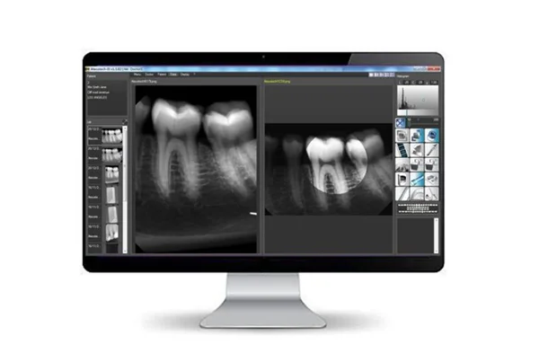 RVG Dental X-Ray